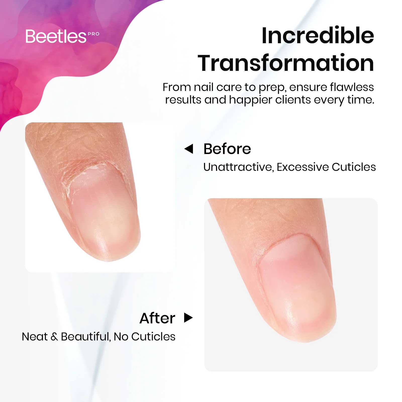 Beetles Pro Cuticle Trimmer Beveled Pusher (9mm) & Loop Pusher (23mm) - Image 6